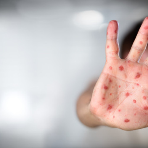 Comitetul consultativ american modifică recomandările privind vaccinarea copiilor sub patru ani